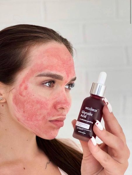 Кислотная сыворотка-пилинг для лица HOLLYSKIN Glycolic Acid 30мл 2598688521 фото